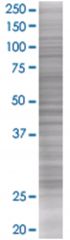 RAB32 293T Cell Overexpression Lysate 2 (Denatured), Abnova