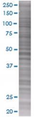  IL24 293T Cell Overexpression Lysate (Denatured), Abnova