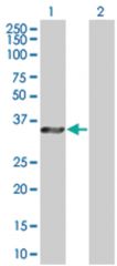  PIM2 293T Cell Overexpression Lysate (Denatured), Abnova