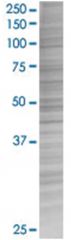  DUSP14 293T Cell Overexpression Lysate (Denatured), Abnova