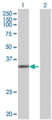  ESM1 293T Cell Overexpression Lysate (Denatured), Abnova