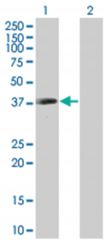  KATNA1 293T Cell Overexpression Lysate (Denatured), Abnova