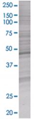  HYPE 293T Cell Overexpression Lysate (Denatured), Abnova