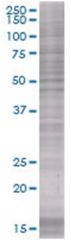  WIF1 293T Cell Overexpression Lysate (Denatured), Abnova