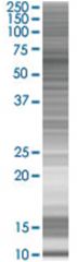  KLHL2 293T Cell Overexpression Lysate (Denatured), Abnova