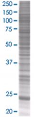  LYPLA2 293T Cell Overexpression Lysate (Denatured), Abnova