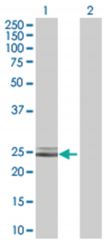  OIP5 293T Cell Overexpression Lysate (Denatured), Abnova