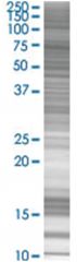  ZNFN1A2 293T Cell Overexpression Lysate (Denatured), Abnova
