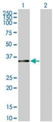  MRAS 293T Cell Overexpression Lysate (Denatured), Abnova