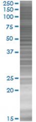  DLGAP4 293T Cell Overexpression Lysate (Denatured), Abnova