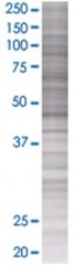  UBR2 293T Cell Overexpression Lysate (Denatured), Abnova