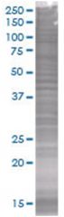  UNC84A 293T Cell Overexpression Lysate (Denatured), Abnova