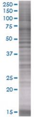  USP24 293T Cell Overexpression Lysate (Denatured), Abnova