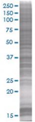 QPRT 293T Cell Overexpression Lysate (Denatured), Abnova