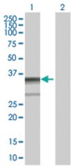  ZNF346 293T Cell Overexpression Lysate (Denatured), Abnova
