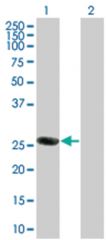  ORC6L 293T Cell Overexpression Lysate 2 (Denatured), Abnova
