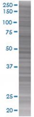  LDOC1 293T Cell Overexpression Lysate (Denatured), Abnova