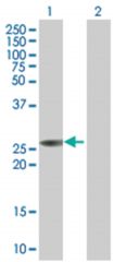  ULK3 293T Cell Overexpression Lysate (Denatured), Abnova