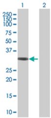  KLHL3 293T Cell Overexpression Lysate (Denatured), Abnova