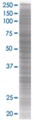  ANGPTL3 293T Cell Overexpression Lysate (Denatured), Abnova