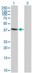 SNX15 293T Cell Overexpression Lysate 2 (Denatured), Abnova