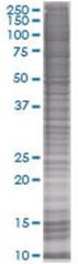  KCNIP1 293T Cell Overexpression Lysate (Denatured), Abnova