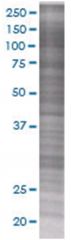  NDUFA13 293T Cell Overexpression Lysate (Denatured), Abnova