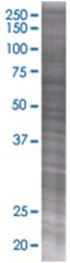  DCXR 293T Cell Overexpression Lysate (Denatured), Abnova