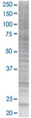  HSPC111 293T Cell Overexpression Lysate (Denatured), Abnova