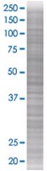  DIRAS2 293T Cell Overexpression Lysate (Denatured), Abnova