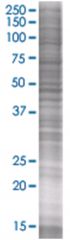  SLC25A36 293T Cell Overexpression Lysate (Denatured), Abnova