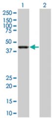  WDR41 293T Cell Overexpression Lysate (Denatured), Abnova