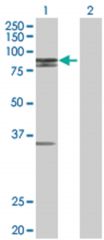  MCCC1 293T Cell Overexpression Lysate (Denatured), Abnova