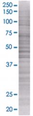  LMBR1 293T Cell Overexpression Lysate (Denatured), Abnova
