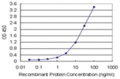  anti-CENPH Matched Antibody Pair, Abnova