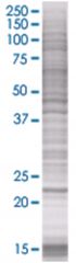  NOL6 293T Cell Overexpression Lysate (Denatured), Abnova