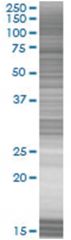  UBE2Z 293T Cell Overexpression Lysate (Denatured), Abnova