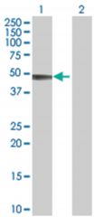  ADCK4 293T Cell Overexpression Lysate (Denatured), Abnova