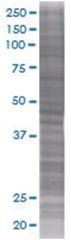  ULBP2 293T Cell Overexpression Lysate (Denatured), Abnova