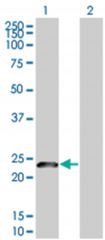  NDFIP1 293T Cell Overexpression Lysate (Denatured), Abnova
