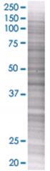  WNT5B 293T Cell Overexpression Lysate (Denatured), Abnova