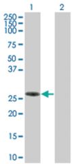 SLA2 293T Cell Overexpression Lysate (Denatured), Abnova