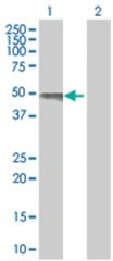  HSH2D 293T Cell Overexpression Lysate 2 (Denatured), Abnova