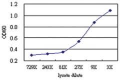 anti-RELT Matched Antibody Pair, Abnova™
