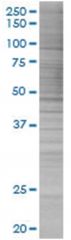 LHX4 293T Cell Overexpression Lysate (Denatured), Abnova