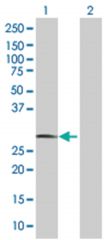  NIP 293T Cell Overexpression Lysate (Denatured), Abnova