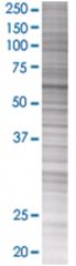  L3MBTL4 293T Cell Overexpression Lysate (Denatured), Abnova