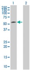  LOC91614 293T Cell Overexpression Lysate (Denatured), Abnova