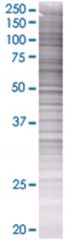  WDR20 293T Cell Overexpression Lysate (Denatured), Abnova