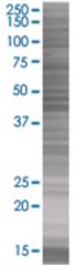  MGC21654 293T Cell Overexpression Lysate (Denatured), Abnova